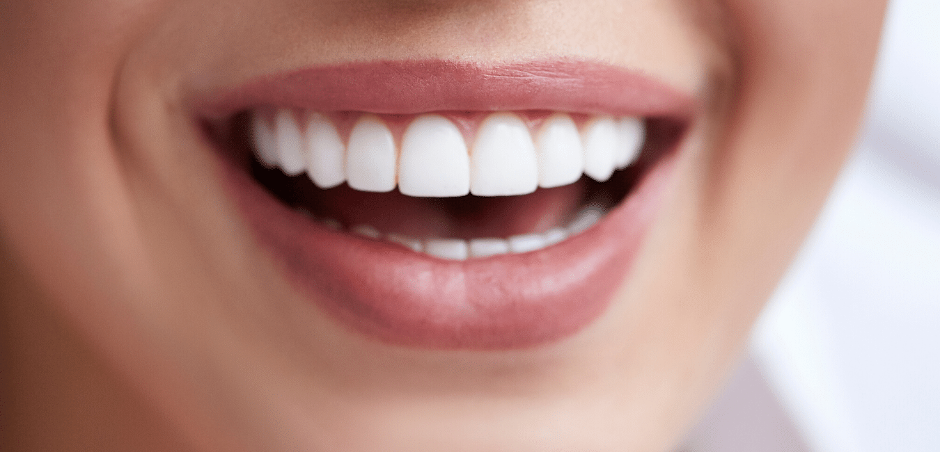 How to choose the best veneers for your face shape