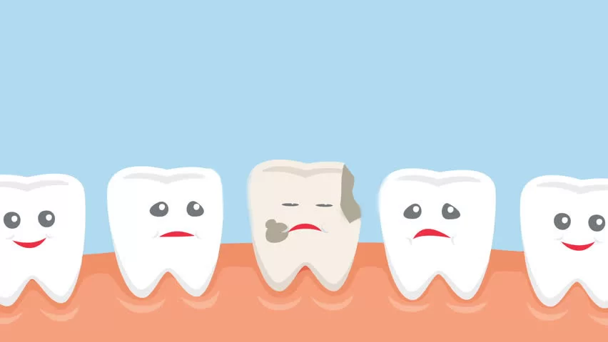 Tooth Decay — The World's Most Widespread Disease