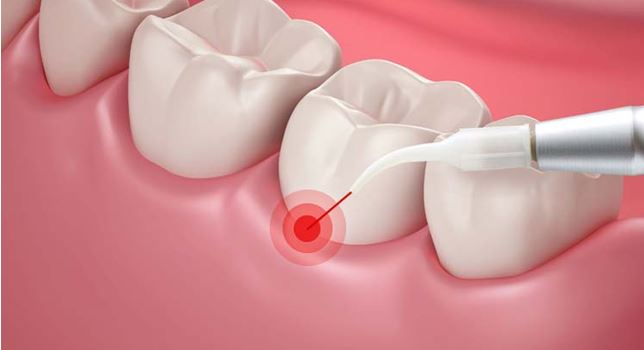 https://65broadwaydental.com/wp-content/uploads/2025/05/64a71632034c8a3bd89faacc_6368ac3c880d0e2eb7a565dbCapture16.jpg
