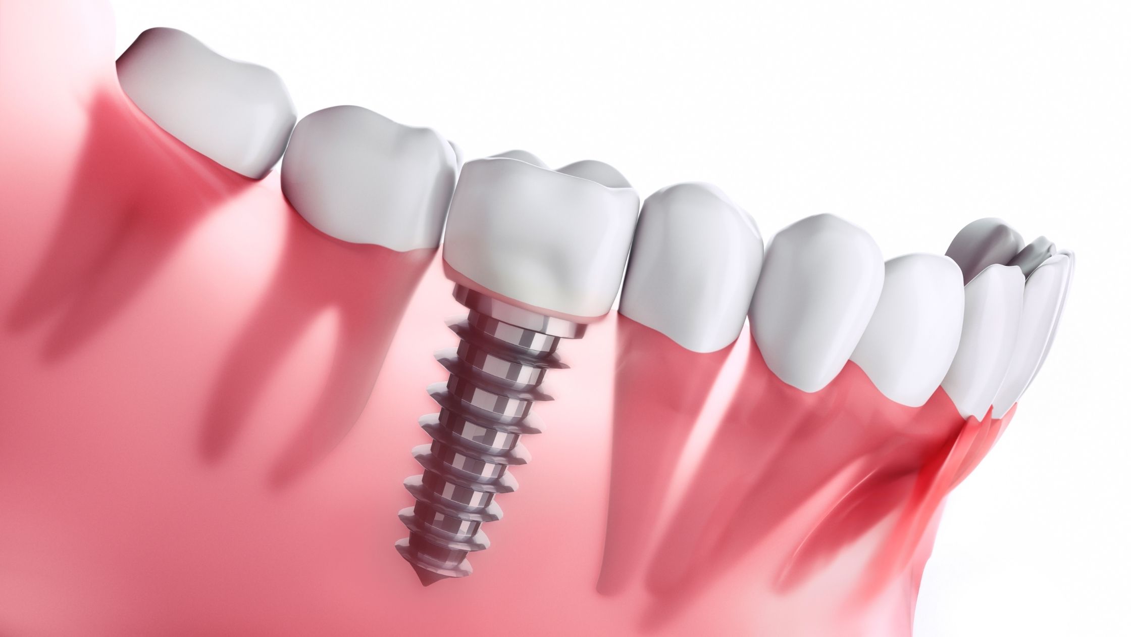 https://65broadwaydental.com/wp-content/uploads/2025/05/8.jpg
