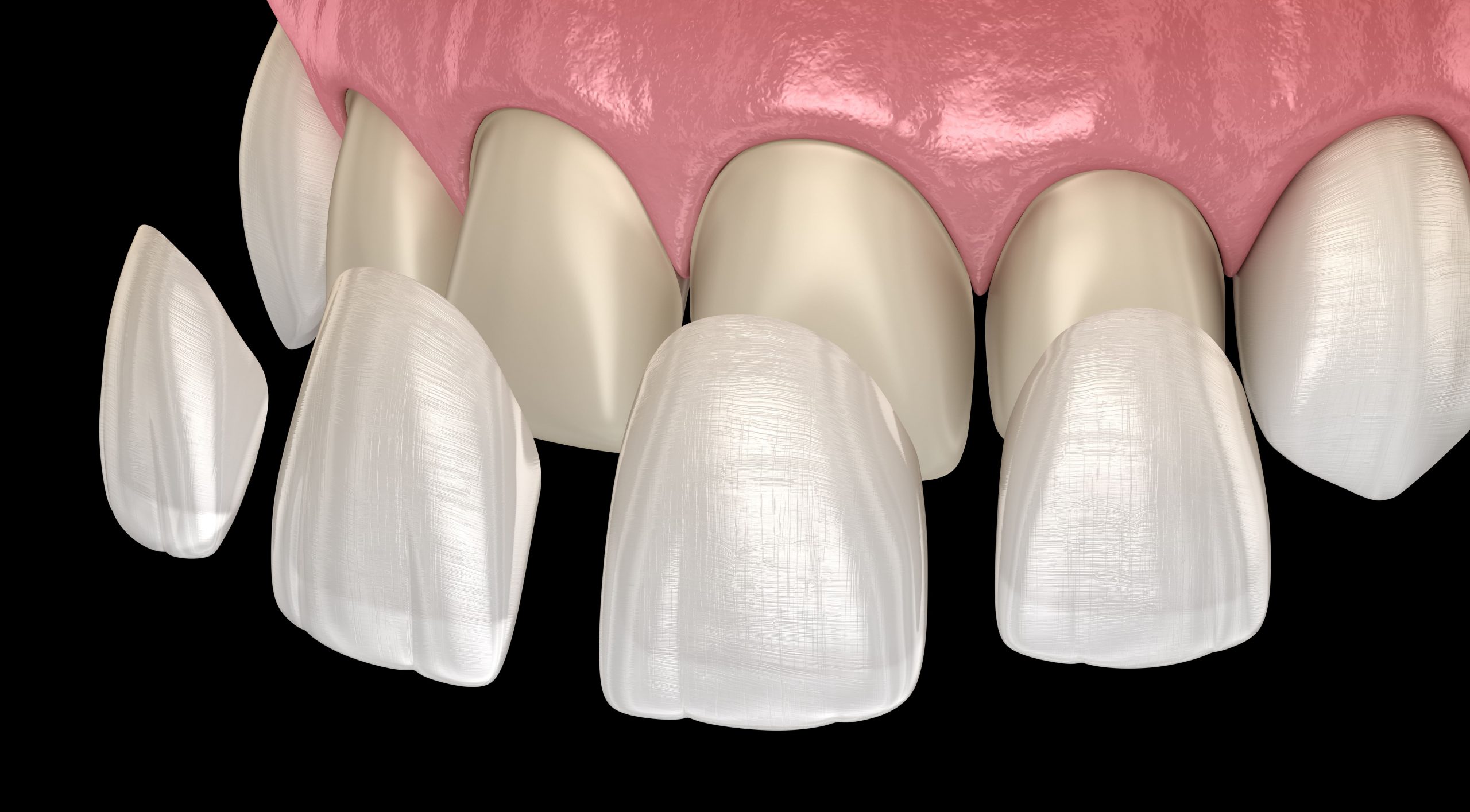 https://65broadwaydental.com/wp-content/uploads/2025/05/AdobeStock_237029769-min-scaled-1.jpeg