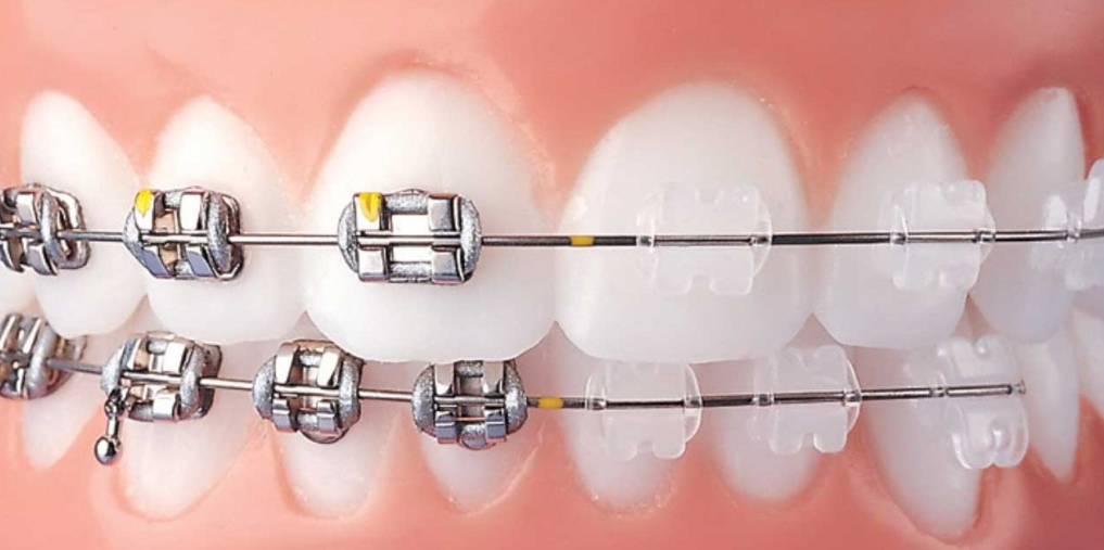 https://65broadwaydental.com/wp-content/uploads/2025/05/a1.png
