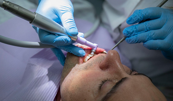 TMJ TREATMENT