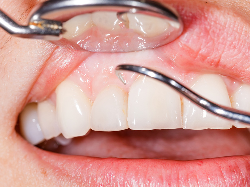 https://65broadwaydental.com/wp-content/uploads/2025/05/dental-biopsy.jpg