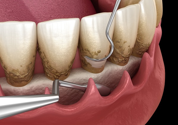 https://65broadwaydental.com/wp-content/uploads/2025/05/periodontics-2110.jpg