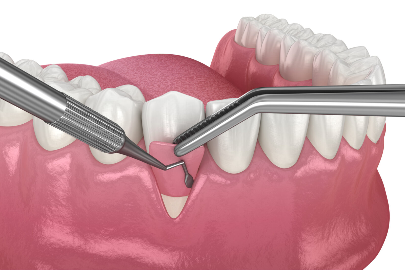 https://65broadwaydental.com/wp-content/uploads/2025/05/shutterstock_1975326155-1600x1068-1.jpg