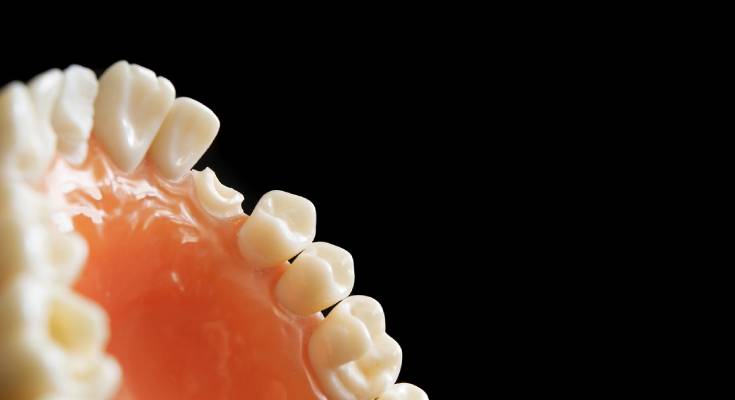 Broken Tooth