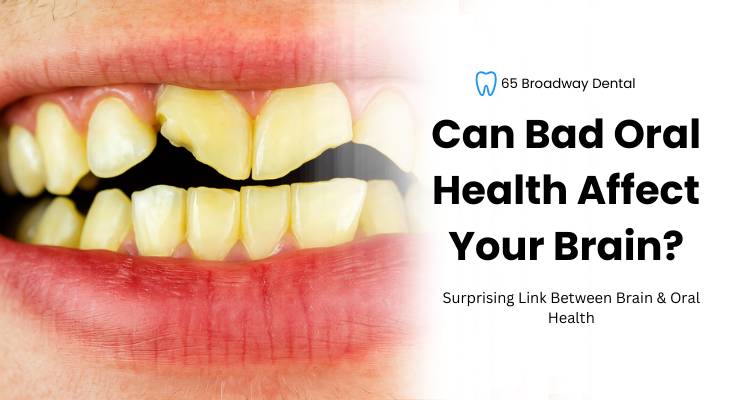 Can Bad Oral Health Affect Your Brain?