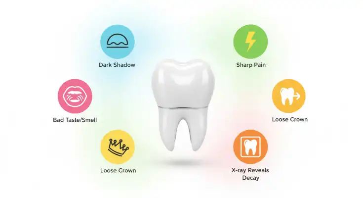 Dad symptoms for tooth decay