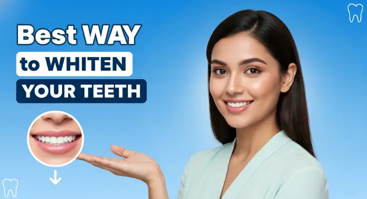 The Best Way to Whiten Your Teeth: Proven Methods That Actually Work